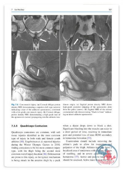 کتاب آسیب‌های ورزشی خاص : راهنمای جامع پیشگیری، و درمان