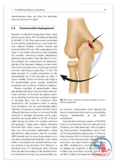 کتاب آسیب‌های ورزشی آرنج : تشخیص، درمان و پیشگیری